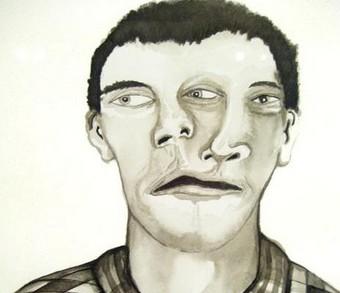 身體疾病會和心理有關嗎？